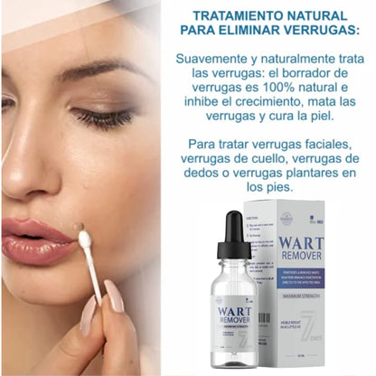 WART-REMOVER-Removedor De Verrugas -2025