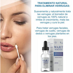 WART-REMOVER-Removedor De Verrugas -2025
